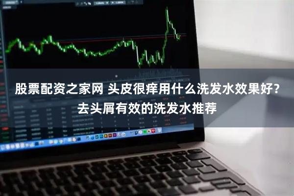 股票配资之家网 头皮很痒用什么洗发水效果好？去头屑有效的洗发水推荐